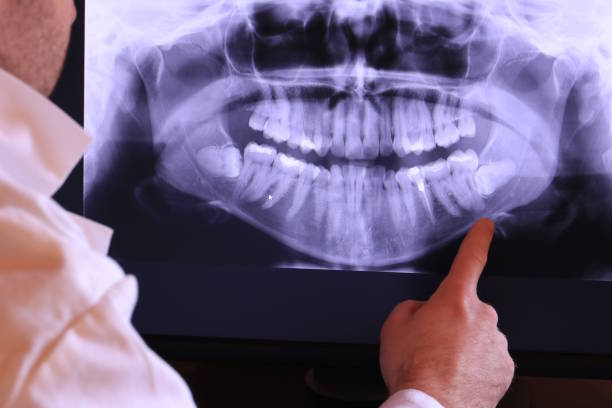 Best Chipped Tooth Repair Near Me  in Eggertsville, NY