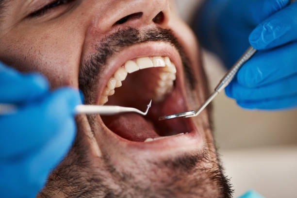 Best Chipped Tooth Repair Near Me  in Eggertsville, NY